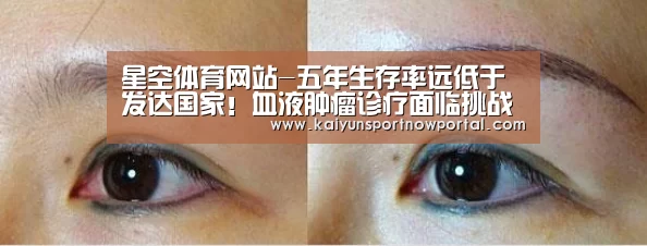 星空体育网站-五年生存率远低于发达国家！血液肿瘤诊疗面临挑战(图3)